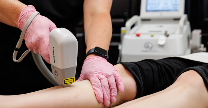 Tattoo Removal "Q-Switched Yag Spectrum Laser"