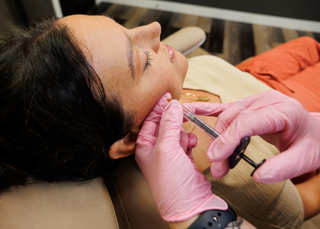 Botox injections for wrinkles and fine lines in Mitchell, SD clinic