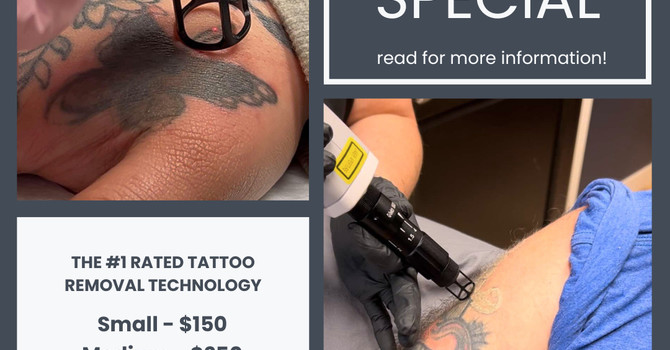 March Special: Pico Laser Tattoo Removal—Fast, Safe & Effective!