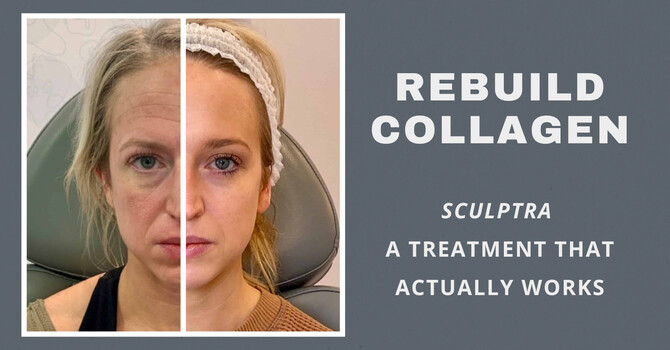 Rediscover Your Glow with Sculptra® Aesthetic at Tailored to You image