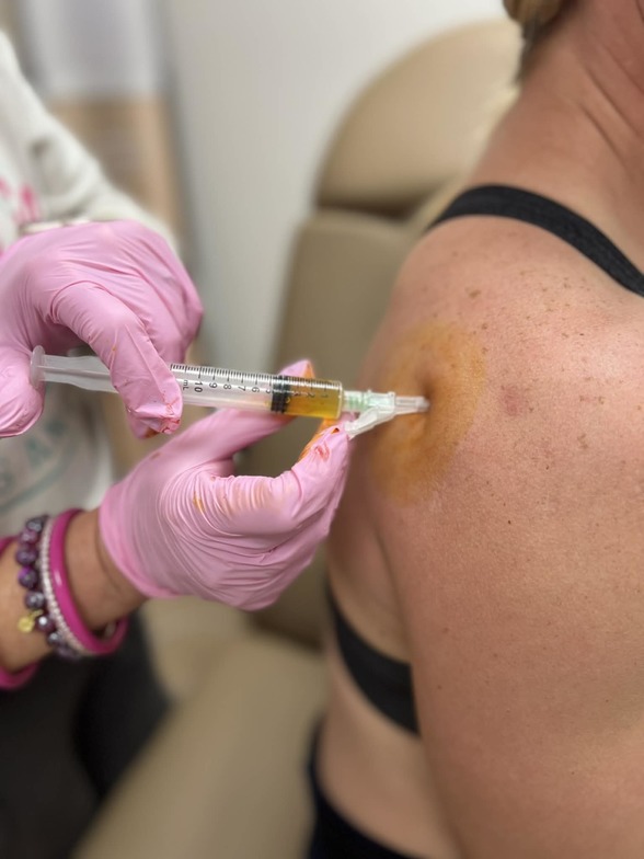 PRP Treatment_injection for pain_pain injection_pain management_tailored to you_mitchell sd_clinic near me (2)