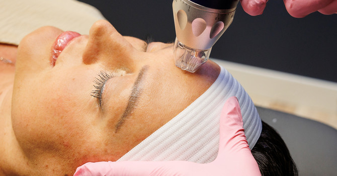 Microneedling Treatments